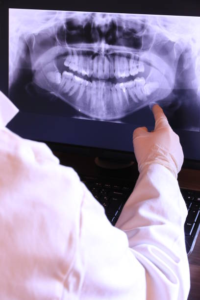 Best Emergency Dental Extractions in Las Lomas, CA